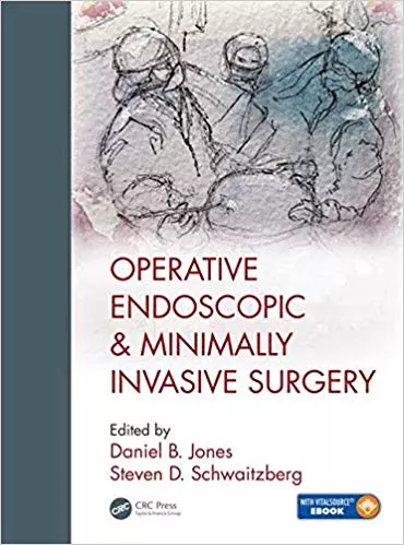 Operative Endoscopic and Minimally Invasive Surgery 2019 By Daniel B. Jones