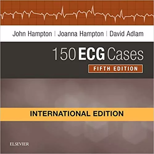 150 Ecg Cases International Edition 5th edition 2019 By John Hampton