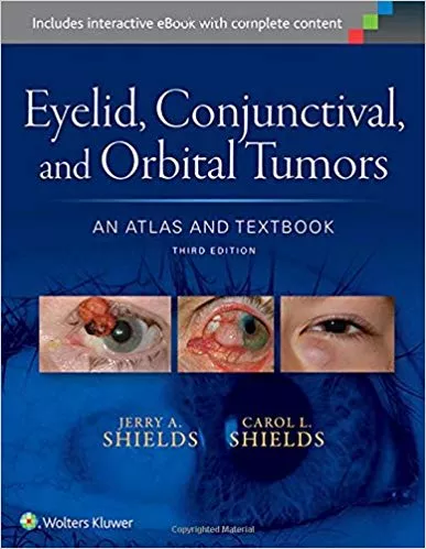 EYELID, CONJUNCTIVAL ,AND ORBITAL TUMORS : AN ATLAS AND TEXTBOOK 3rd EDITION 2015 BY SHIELDS