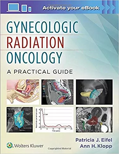 GYNECOLOGIC RADIATION ONCOLOGY: A PRACTICAL GUIDE (E), 1ST EDITION 2016 BY EIFEL