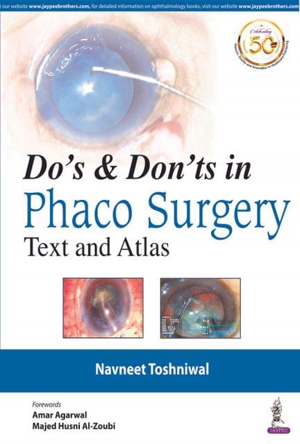 Do's & Don'ts in  PHACO SURGERY 2020 By Navneet Toshniwal