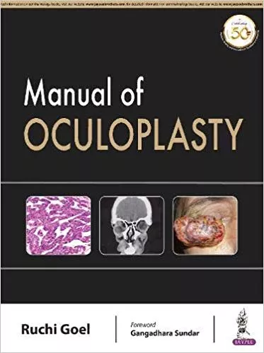Manual Of Oculoplasty 1st Edition 2019 Ruchi Goel