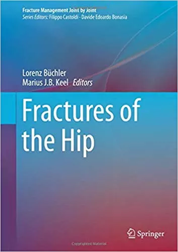 Fractures of the Hip (Fracture Management Joint by Joint) 2019 By Lorenz B__chler