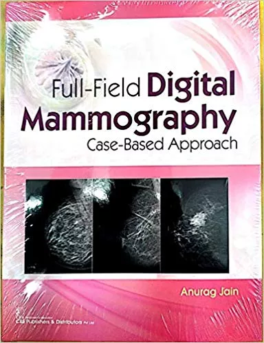 FULL FIELD DIGITAL MAMMOGRAPHY CASE BASED APPROACH 2020 By JAIN A