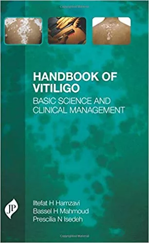 Handbook of Vitiligo: Basic Science and Clinical Management 2015 by Iltefat Hamzavi