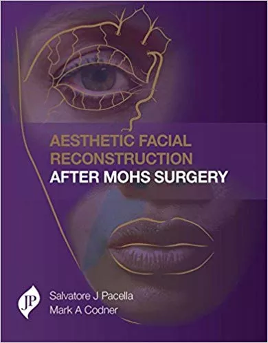 Aesthetic Facial Reconstruction After Mohs Surgery 1st Edition 2017 by Salvatore Pacella