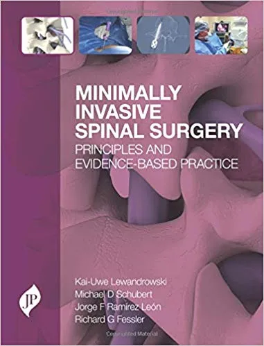 Minimally Invasive Spinal Surgery: Principles and Evidence-Based Practice 2018 by Kai-Uwe Lewandrowski