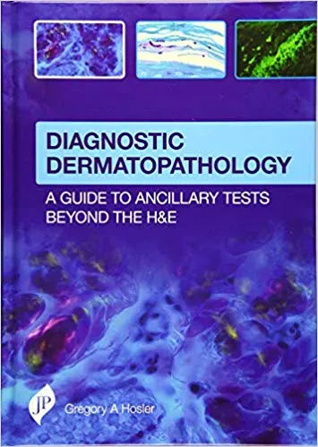 Diagnostic Dermatopathology: A Guide to Ancillary Tests Beyond the H&E 2016 by Gregory Hosler
