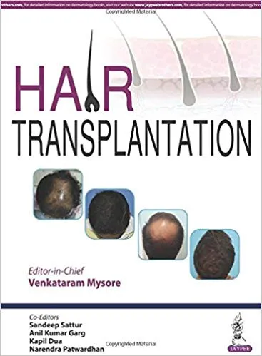 Hair Transplantation 1st Edition 2016 by Mysore Venkataram