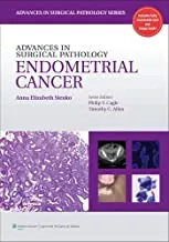 Advances in Surgical Pathology: Endometrial Carcinoma