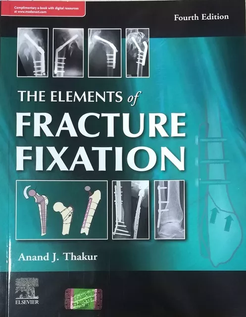 The Elements of Fracture Fixation 4th Edition 2019 By Anand J Thakur