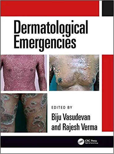 Dermatological Emergencies 2019 By Rajesh Verma