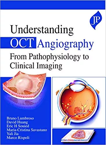 Understanding OCT Angiography From Pathophysiology To Clinical Imaging 2020 By Bruno Lumbroso
