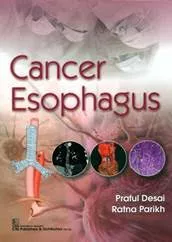 Cancer Esophagus 2019 By Praful Desai