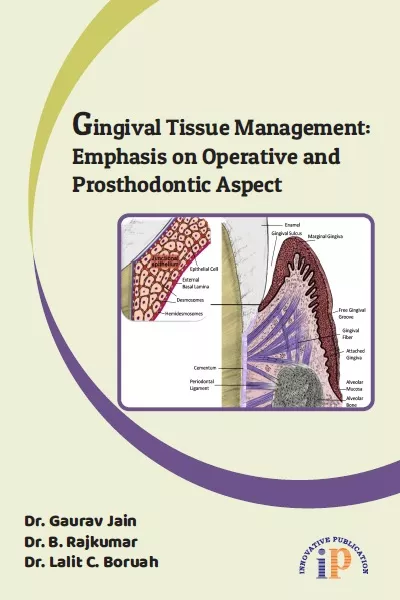 Gingival Tissue Management: Emphasis on Operative and Prosthodontic Aspect, First Edition, December 2019, By Dr. Gaurav Jain, Dr. B. Rajkumar, Dr. Lalit C. Boruah