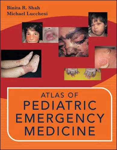 Atlas of Pediatric Emergency Medicine Hardcover , 16 May 2006 by Binita Shah