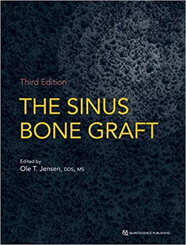 The Sinus Bone Graft 3rd Edition 2019 By DDS Jensen