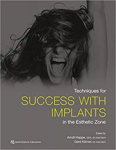 Techniques for Success With Implants in the Esthetic Zone 2019 By Arndt Happe