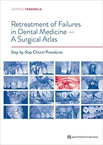 Retreatment of Failures in Dental Medicine- A Surgical Atlas 2019 By Tabanella