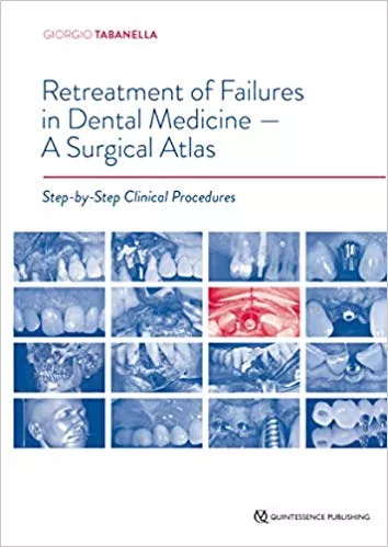 Retreatment of Failures in Dental Medicine- A Surgical Atlas 2019 By Tabanella