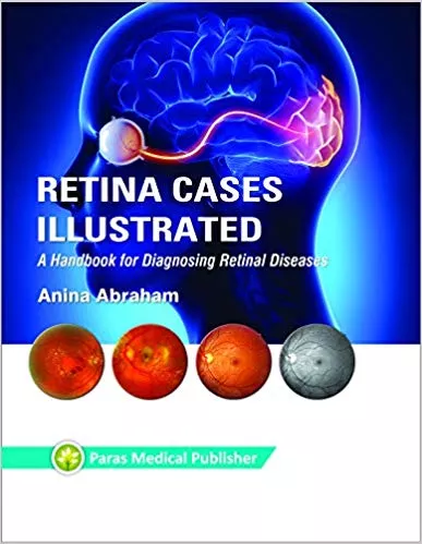 Retina Cases Illustrated 1st Edition 2019 By Anina Abraham