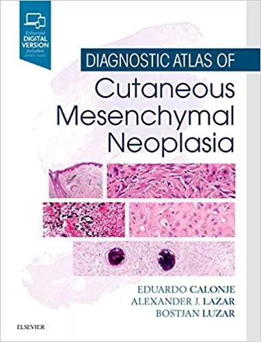 Diagnostic Atlas of Cutaneous Mesenchymal Neoplasia 1st Edition 2019 By J. Eduardo Calonje