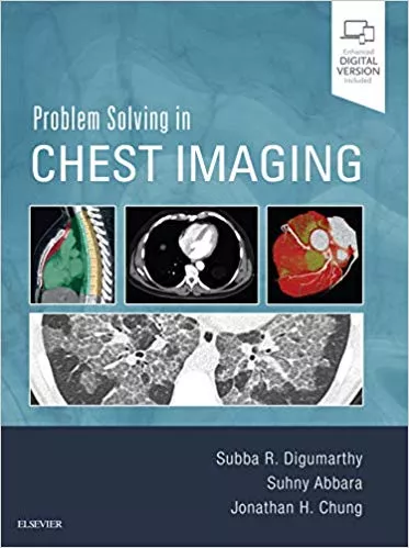 See this image Problem Solving in Chest Imaging 1st Edition 2019 By Subba R. Digumarthy
