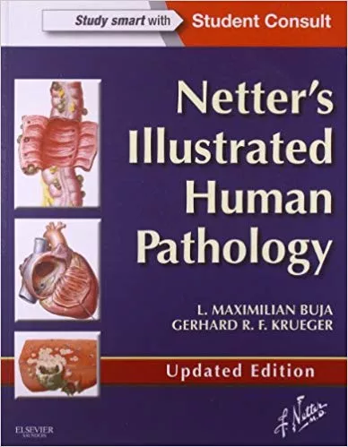 Netter's Illustrated Human Pathology 2020 By L. Maximilian Buja