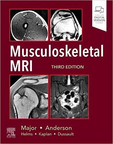 Musculoskeletal MRI 3rd Edition 2020 By Nancy M. Major