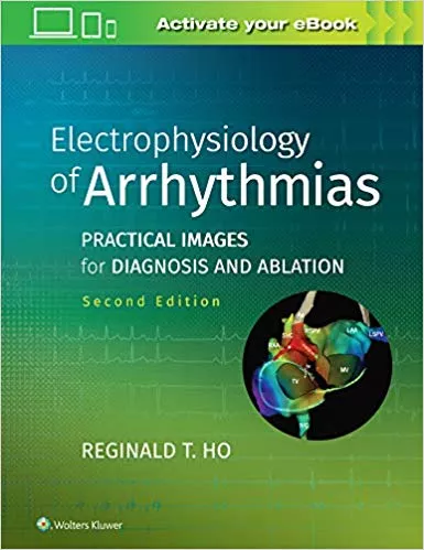 Electrophysiology of Arrhythmias: Practical Images for Diagnosis and Ablation 2nd Edition 2019 By Reginald T. Ho