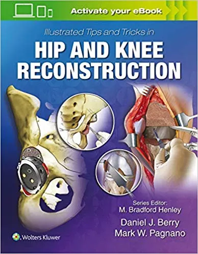 llustrated Tips and Tricks in Hip and Knee Reconstructive and Replacement Surgery 2019 By Daniel J. Berry