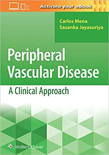 Peripheral Vascular Disease: A Clinical Approach 2020 By Carlos Mena
