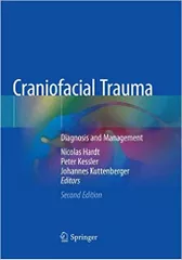 Craniofacial Trauma: Diagnosis and Management 2nd Edition 2019 By Nicolas Hardt