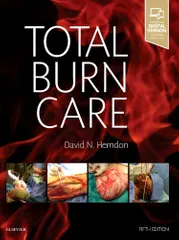 Total Burn Care Hardcover �  2018 by Herndon