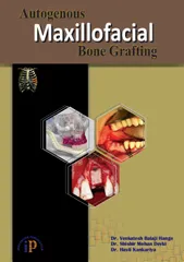 Autogenous Maxillofacial Bone Grafting, First Edition 2020, By Dr. Venkatesh Balaji Hange, Dr. Shishir Mohan Devki, Dr. Hasti Kankariya
