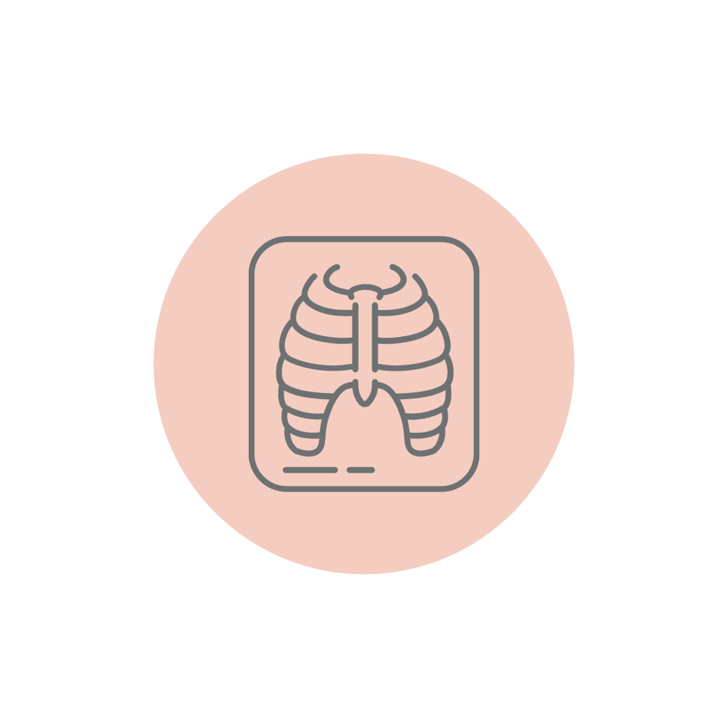 X-Ray Chest Right Lateral