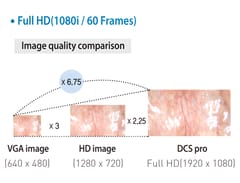 Endoskopický kamerový systém DSC-103E Pro pro laparoskopii a endoskopii